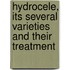 Hydrocele, Its Several Varieties And Their Treatment