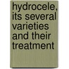Hydrocele, Its Several Varieties And Their Treatment by Samuel Osborn