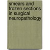 Smears And Frozen Sections In Surgical Neuropathology door Peter Burger