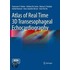 Atlas Of Real Time 3d Transesophageal Echocardiography