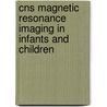 Cns Magnetic Resonance Imaging In Infants And Children door Eric N. Farber