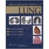 High-resolution Ct Of The Lung [with Online Access Code]