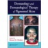 Dermatology and Dermatological Therapy of Pigmented Skins