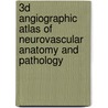 3D Angiographic Atlas of Neurovascular Anatomy and Pathology door Neil M. Borden
