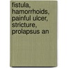 Fistula, Hamorrhoids, Painful Ulcer, Stricture, Prolapsus an door William Allingiham