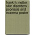 Frank H. Netter Skin Disorders - Psoriasis And Eczema Poster