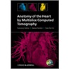 Anatomy Of The Heart By Multislice Computed Tomography [with Cdrom] door Siew Yen Ho