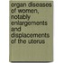 Organ Diseases Of Women, Notably Enlargements And Displacements Of The Uterus