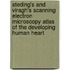 Steding's and Viragh's Scanning Electron Microscopy Atlas of the Developing Human Heart