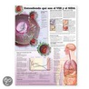 Understanding Hiv And Aids Anatomical Chart In Spanish (entendiendo Que Son El Vih Y El Sida) door Anatomical Chart Company