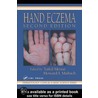 Hand Eczema door Torkil Menne