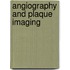 Angiography and Plaque Imaging