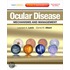 Ocular Disease