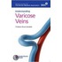 Varicose Veins