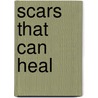 Scars That Can Heal door Louis David