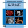 Ct Coronary Angiography door U. Hoffmann