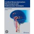 Cerebral Revascularization
