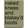Naked Knees And Blakey'd Boots door Brian Lynch