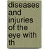 Diseases And Injuries Of The Eye With Th