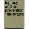 Leprosy And Its Prevention : Illustrated door Robson Roose