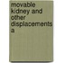 Movable Kidney And Other Displacements A