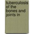 Tuberculosis Of The Bones And Joints In