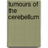 Tumours Of The Cerebellum
