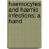 Haemocytes And Hæmic Infections; A Hand