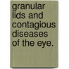 Granular Lids And Contagious Diseases Of The Eye. door William Frederick Mittendorf