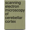 Scanning Electron Microscopy of Cerebellar Cortex door Orlando J. Castejon