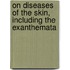 On Diseases of the Skin, Including the Exanthemata