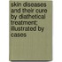 Skin Diseases And Their Cure By Diathetical Treatment; Illustrated By Cases