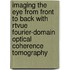 Imaging The Eye From Front To Back With Rtvue Fourier-Domain Optical Coherence Tomography