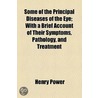 Some Of The Principal Diseases Of The Eye; With A Brief Account Of Their Symptoms, Pathology, And Treatment door Henry Power