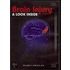 Brain Injury