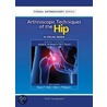 Arthroscopic Techniques Of The Hip by Marc J. Philippon