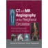 Ct And Mr Angiography Of The Peripheral Circulation