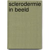 Sclerodermie in beeld by Barry van Velthoven