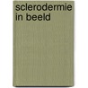 Sclerodermie in beeld door Barry van Velthoven