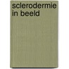 Sclerodermie in beeld door Barry van Velthoven