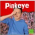 Pinkeye