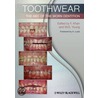 Toothwear by William George Young