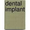 Dental Implant door Frederic P. Miller