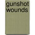 Gunshot Wounds