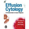 Effusion Cytology by Ph.d. Jorda Merce