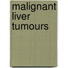 Malignant Liver Tumours door J. Bruix