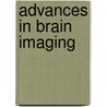 Advances in Brain Imaging door John M. Morihisa