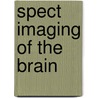 Spect Imaging of the Brain door Roderick Duncan