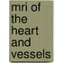 Mri Of The Heart And Vessels