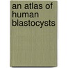 An Atlas of Human Blastocysts door Lucinda L. Veeck